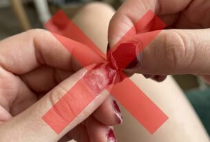 Arrancar o esmalte em gel com as mãos pode levar parte da superfície da unha: os cuidados que tornam a remoção menos agressiva
