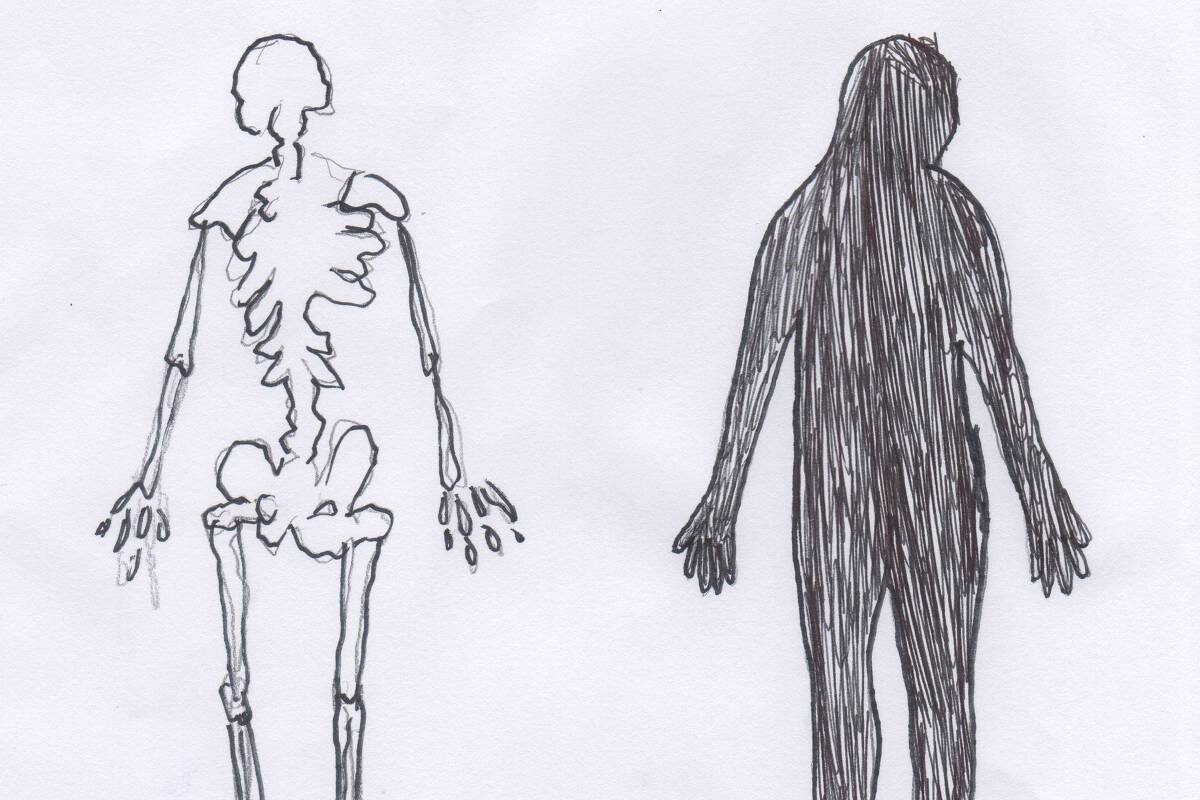 Casos de anorexia e bulimia crescem 71% em duas décadas