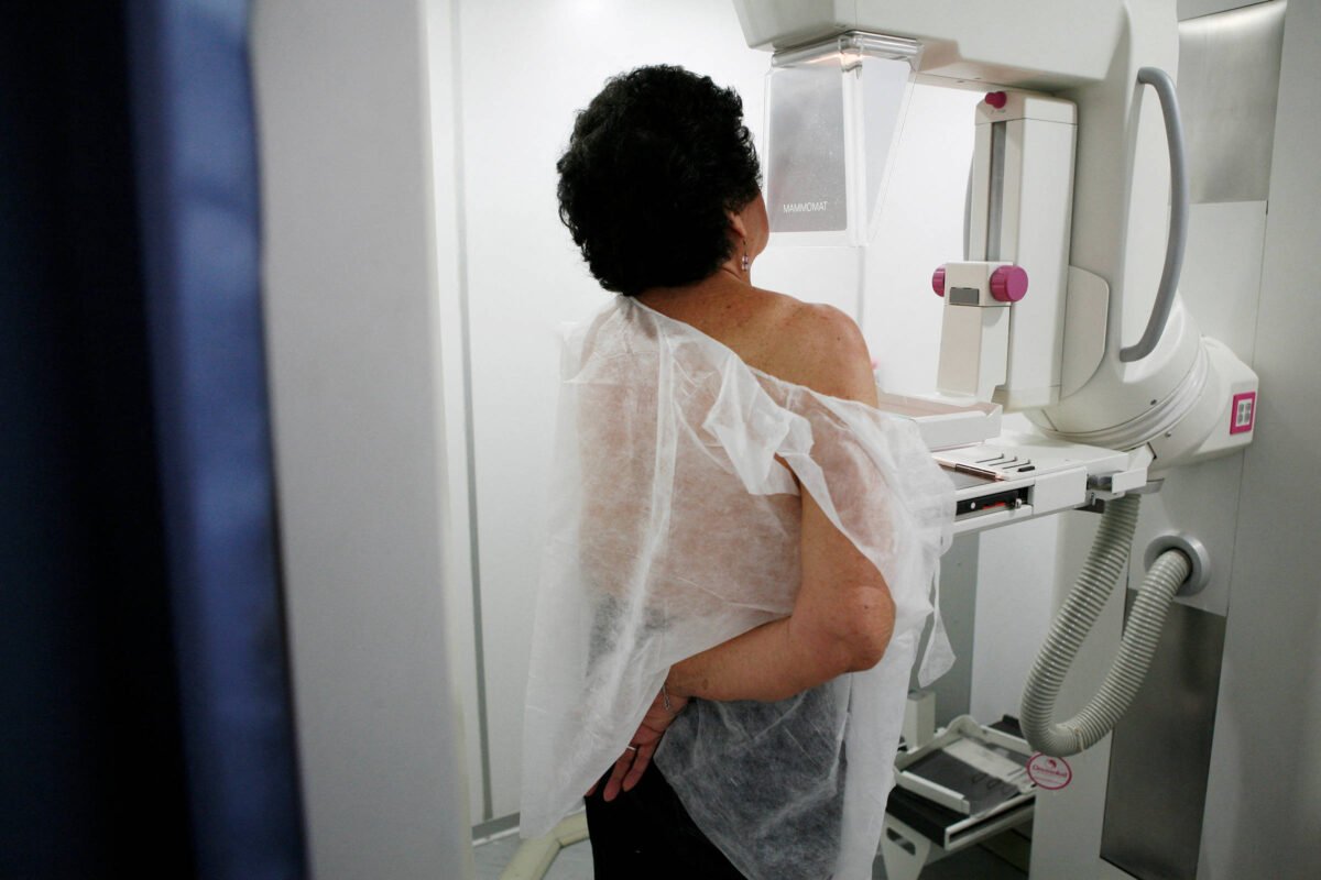 Desigualdade reduz acesso de mulheres negras e indígenas à mamografia