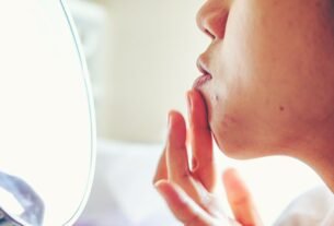 Dieta rica em alimentos antioxidantes ajuda a melhorar a acne, diz estudo