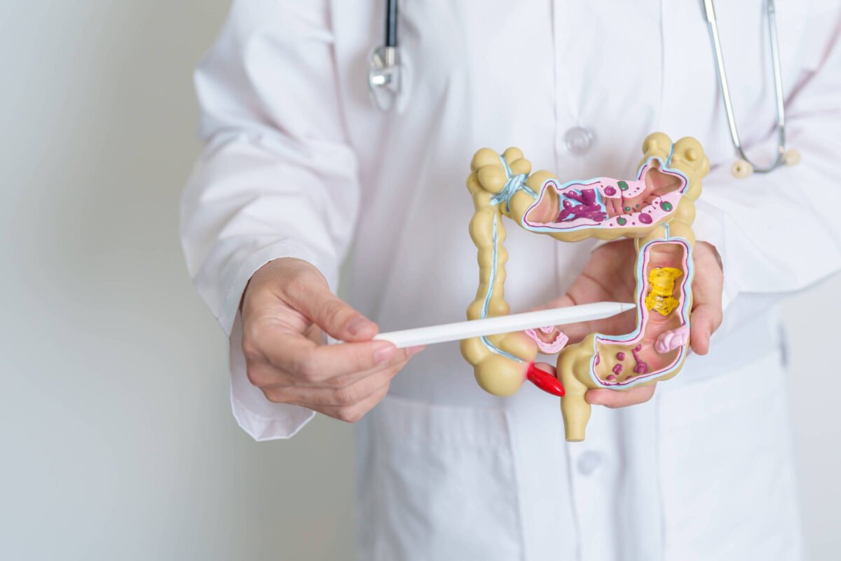 Estudo aponta possíveis causas da agressividade do câncer de intestino em jovens