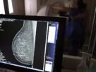 Médicos lançam guia para evitar recusa de mamografia digital