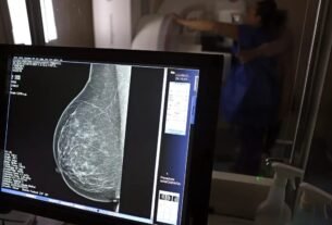 Médicos lançam guia para evitar recusa de mamografia digital