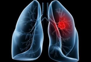 Saiba o que é adenocarcinoma pulmonar, câncer que atinge o papa