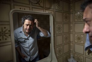 Seis meses após transplante capilar, jornalista relata foliculite e melhora ainda incompleta