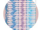 This implant can restore sight for patients with macular degeneration